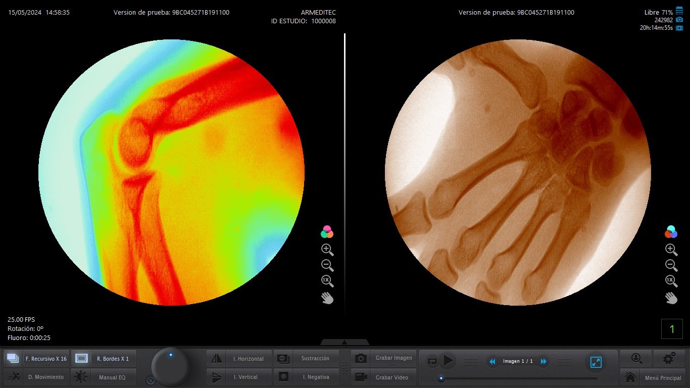 Filtros Cromático y Herramientas de Medición en Microvision 📐🎨